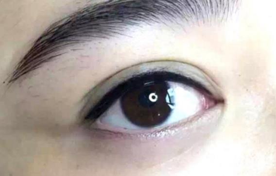 激光洗眼線效果好嗎?洗眼線疼嗎?