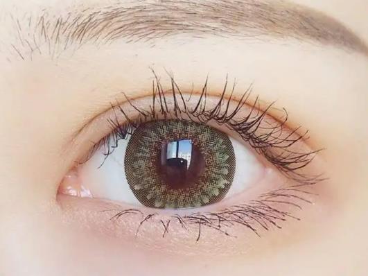 雙眼皮太寬太深去哪里修復(fù)好?雙眼皮疤痕凹陷能自然長平嗎 雙眼皮太寬太深去哪里修復(fù)好?雙眼皮疤痕凹陷能自然長平嗎