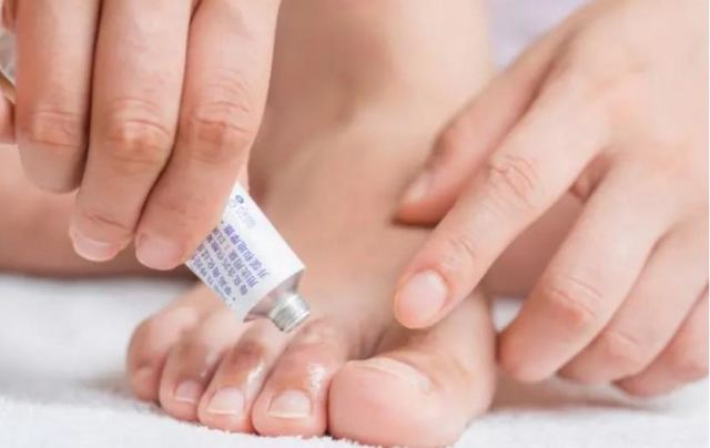 腳氣真菌最怕什么 100℃能殺死腳氣真菌嗎 腳氣真菌最怕什么 100℃能殺死腳氣真菌嗎