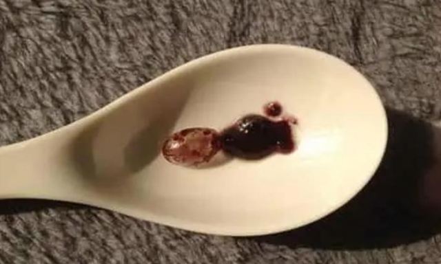 葡萄籽膠囊要怎么吃才好 Swisse葡萄籽精華的功效有哪些 葡萄籽膠囊要怎么吃才好 Swisse葡萄籽精華的功效有哪些