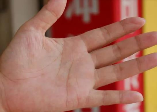 為什么戴戒指手指變綠?戴戒指手指起泡還瘙癢怎么回事 為什么戴戒指手指變綠?戴戒指手指起泡還瘙癢怎么回事