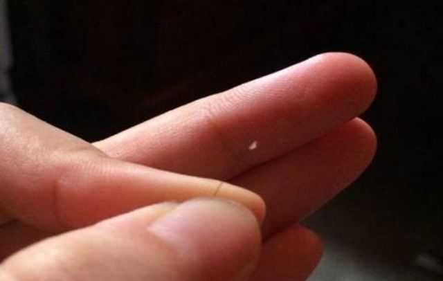 掉了頭發的毛囊還會長嗎 毛囊受損會掉頭發嗎 掉了頭發的毛囊還會長嗎 毛囊受損會掉頭發嗎