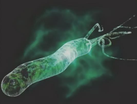 幽門螺桿菌掛什么科治療?幽門螺桿菌感染怎么辦 幽門螺桿菌掛什么科治療?幽門螺桿菌感染怎么辦