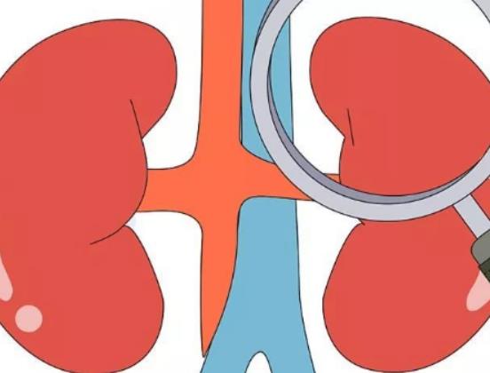 腎結石會感染嗎?腎結石小便出血嚴重嗎 腎結石會感染嗎?腎結石小便出血嚴重嗎