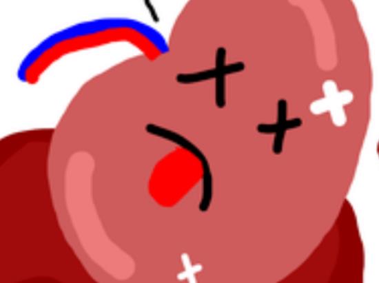 腎結(jié)石會引起腎衰嗎?腎結(jié)石震碎后多久排出 腎結(jié)石會引起腎衰嗎?腎結(jié)石震碎后多久排出