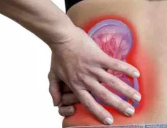 腎結(jié)石會引起腎衰嗎?腎結(jié)石震碎后多久排出 腎結(jié)石會引起腎衰嗎?腎結(jié)石震碎后多久排出